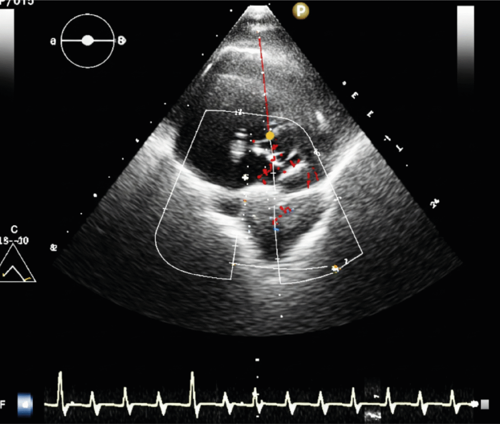 Diagnostic services - Echocardiography