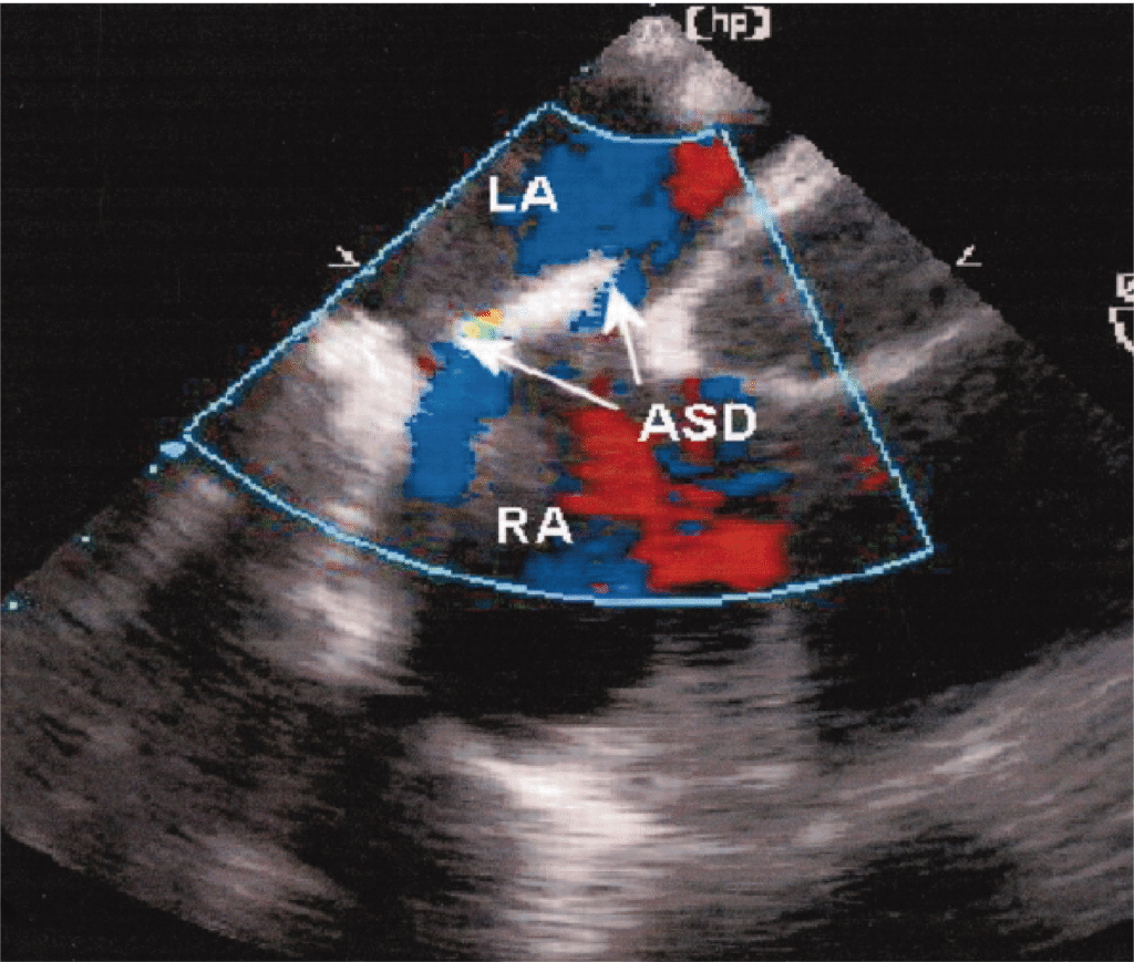 Diagnostic services - Cardiac Catheterization